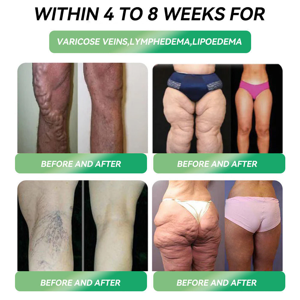 (HHVBยฎ) โค๏ธ Only 6 boxes left! Get 30% off today! The GLP-1 oral solution helps manage weight and blood sugar, with lasting results in 4โ6 boxes. Donโt waitโact fast!